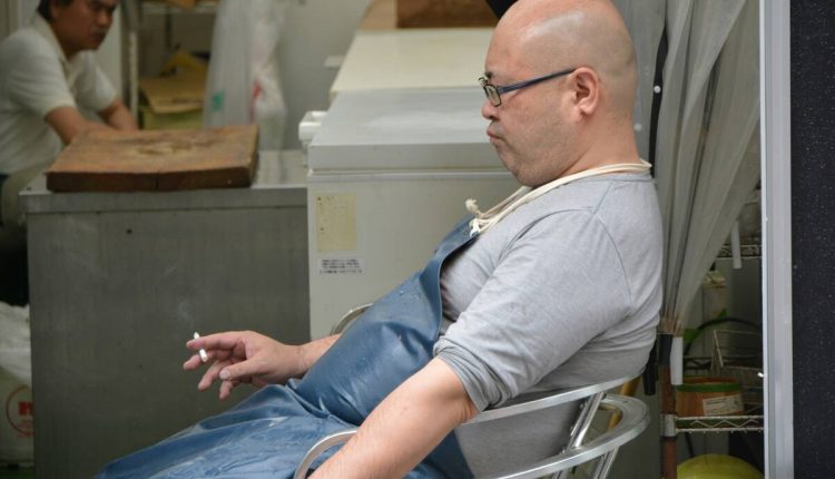 Hair transplant in Turkey