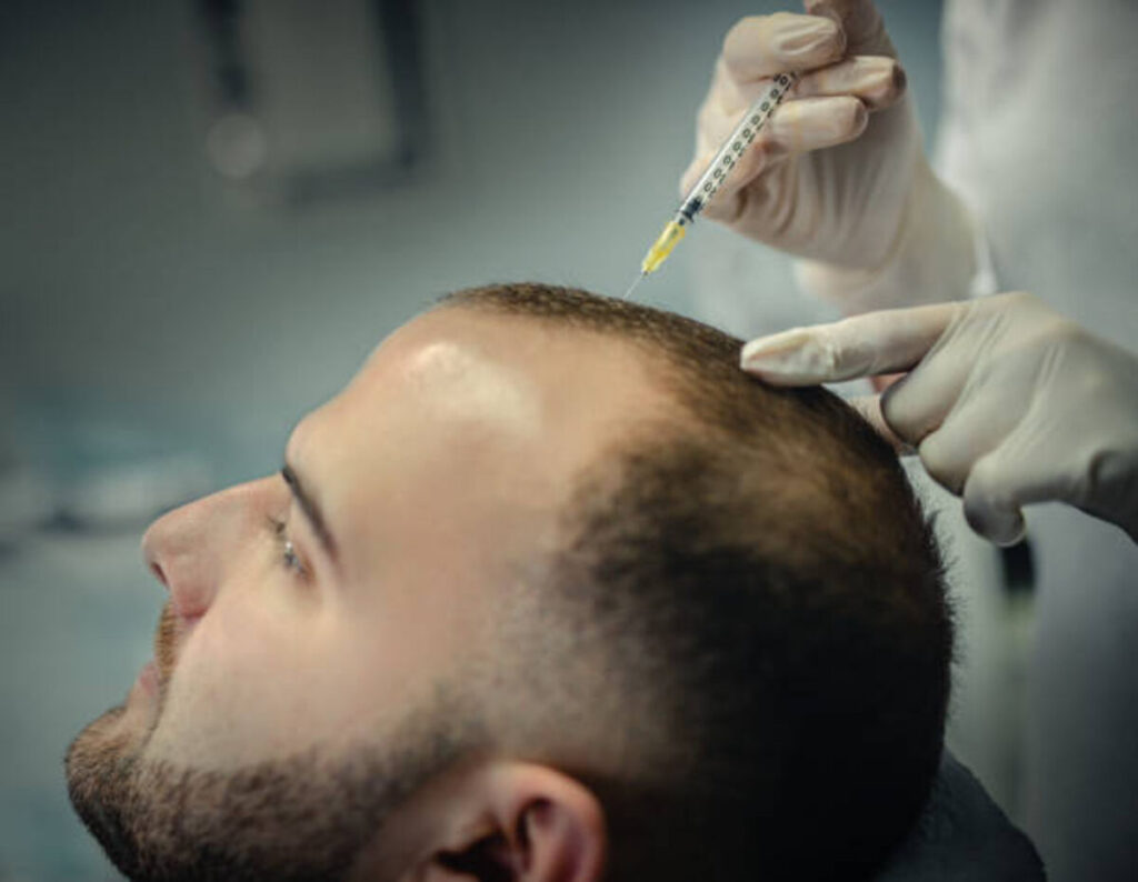Hair Loss Treatment For Men